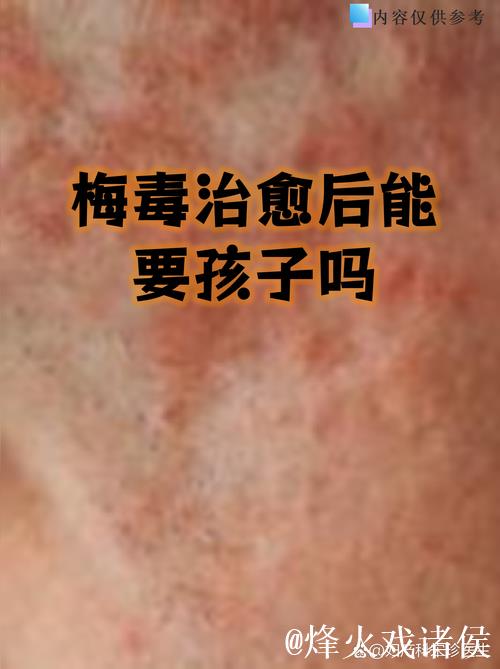 德甲德乙中首位确诊球员康复“解禁”